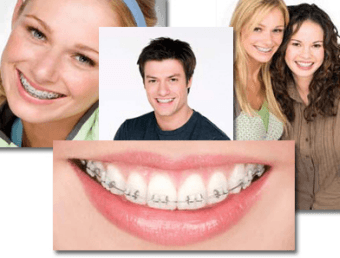 ortodoncia dentistas en Lima
